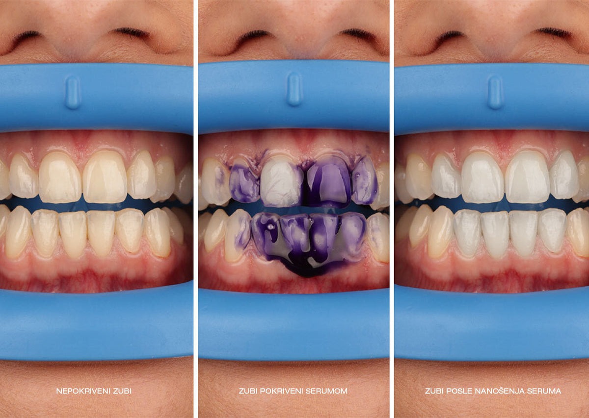 تاثیر خمیردندان v34